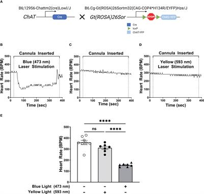 Optogenetic stimulation of the brainstem dorsal motor nucleus ameliorates acute pancreatitis